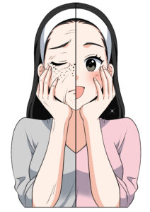 シミありなし