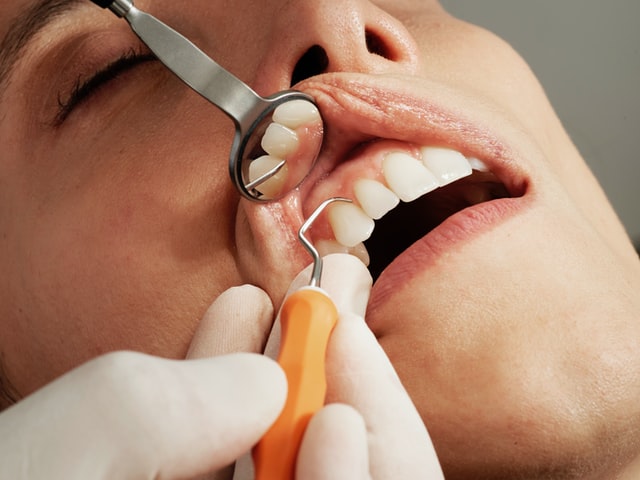 歯の治療の様子